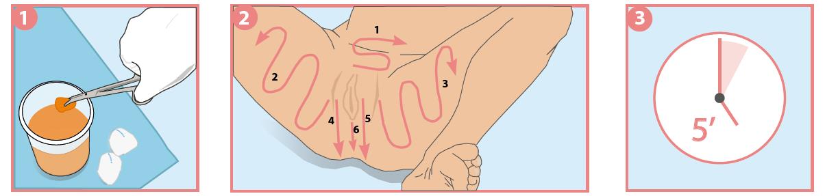 protocolo antisepsia cesarea1